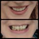 Slider image (10) Dr. Aleksandar Kovacevic - Dental Clinic in Croatia